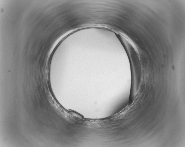 X0000085311148200704092316