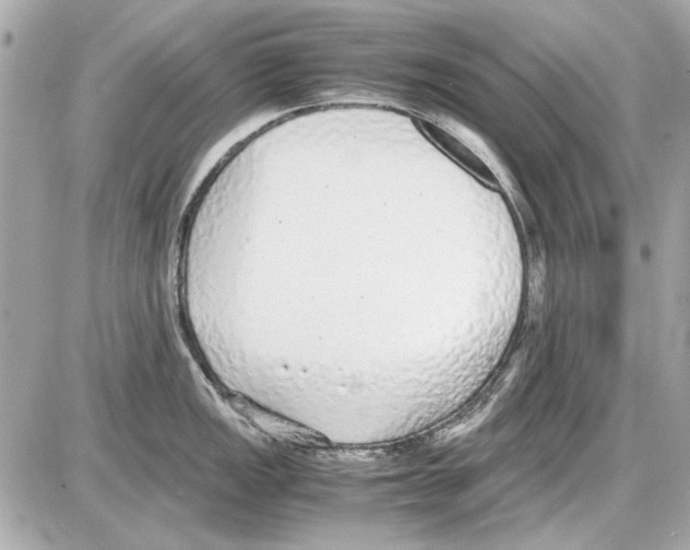 X0000085311149200704092317