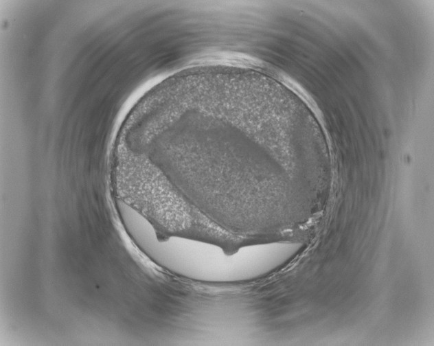 X0000085311152200704092317