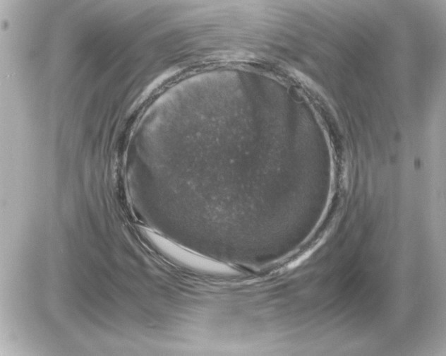 X0000085311161200704092316