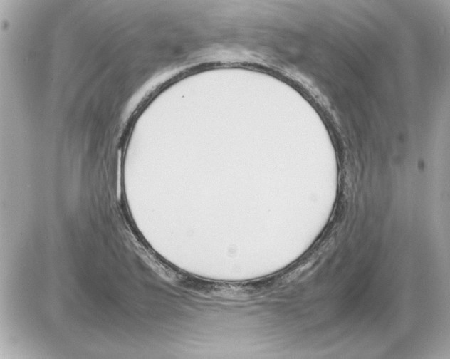 X0000085311175200704092315