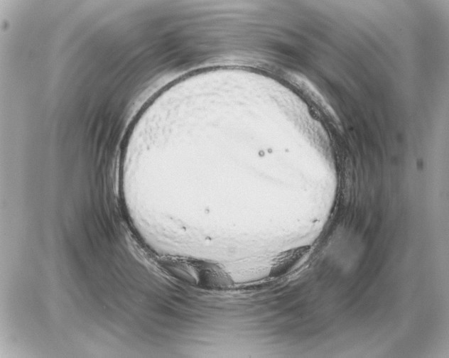 X0000085311276200704092314