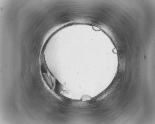 X0000085311335200704092313