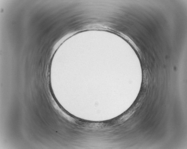 X0000085311387200704092312