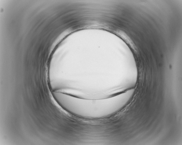 X0000085311476200704092310