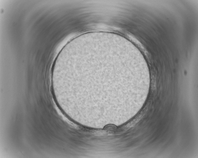 X0000085311479200704092310