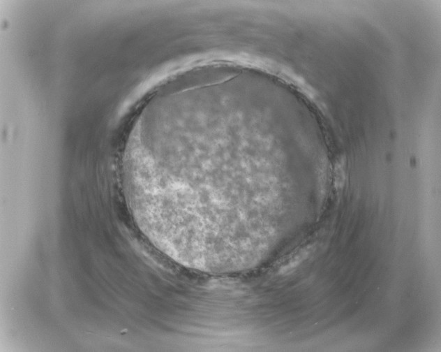 X0000085311496200704092310