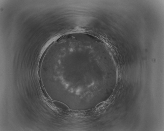 X0000085320147200703161514