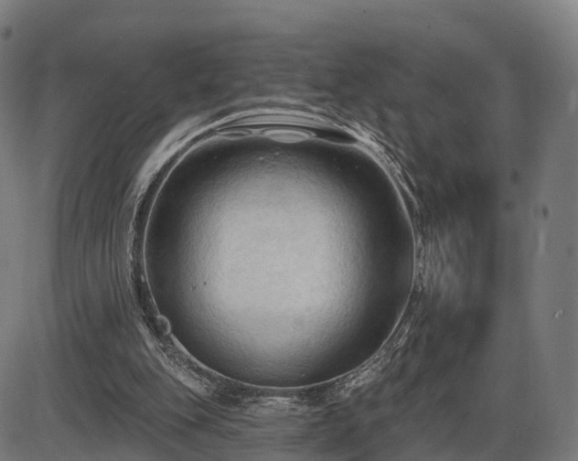 X0000085320151200703161514