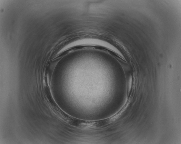 X0000085320170200703161515