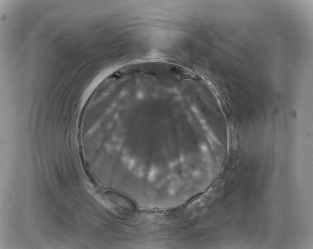 X0000085320147200703231958