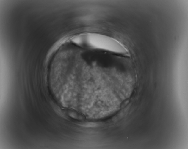 X0000085320149200703302052