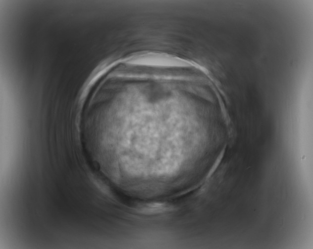 X0000085320151200703302052