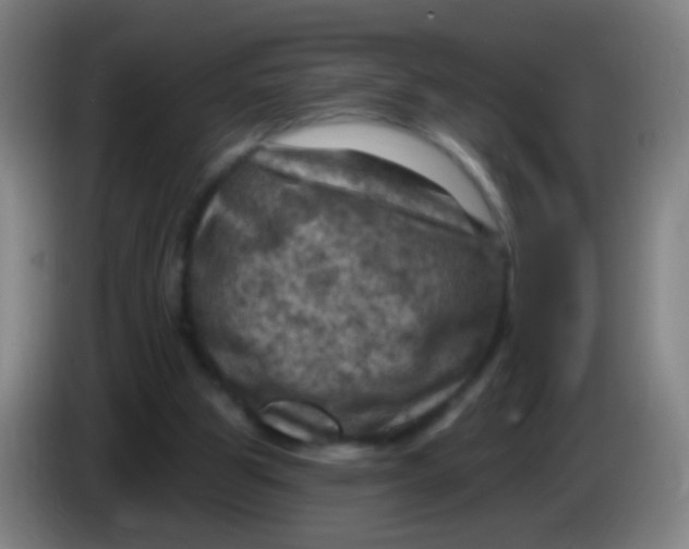 X0000085320153200703302052