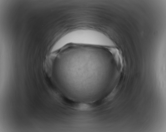 X0000085320176200703302052