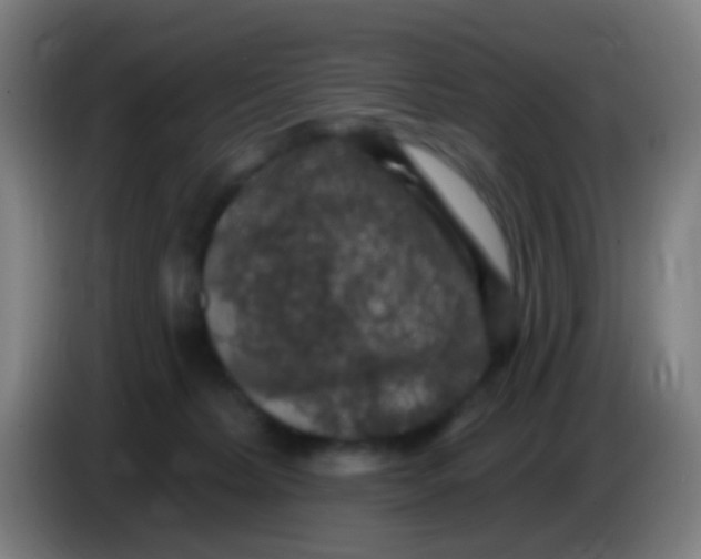 X0000085320228200703302051