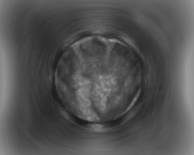 X0000085320265200703302051