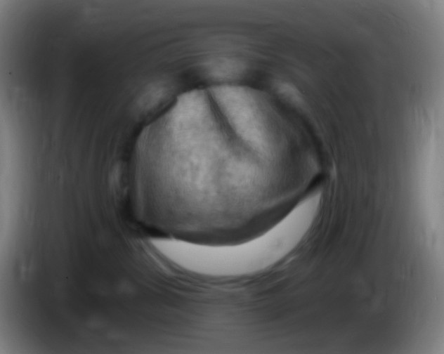 X0000085320428200703302048
