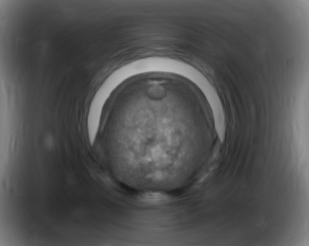 X0000085320429200703302048