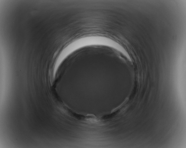 X0000085320516200703302047