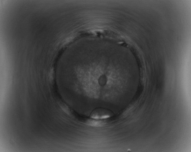 X0000085320563200703302047