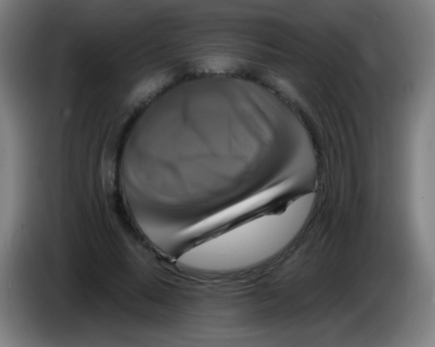 X0000085320640200703302045