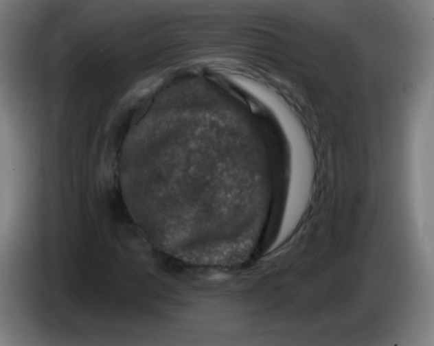 X0000085321014200703302039