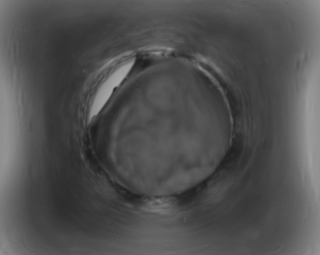X0000085321303200703302035