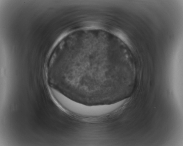 X0000085321476200703302033