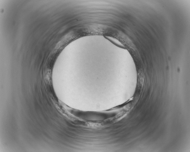 X0000085320141200704092358