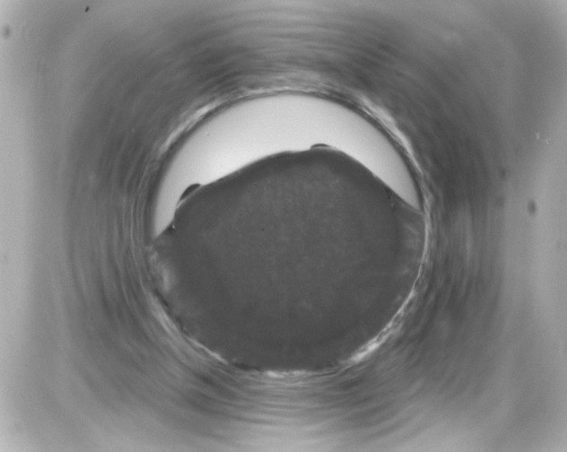 X0000085320154200704092357