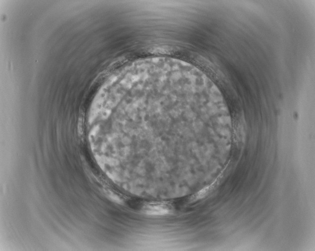 X0000085320175200704092358