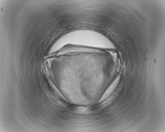 X0000085320176200704092358