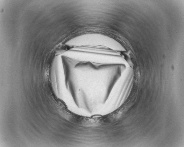 X0000085320329200704092355
