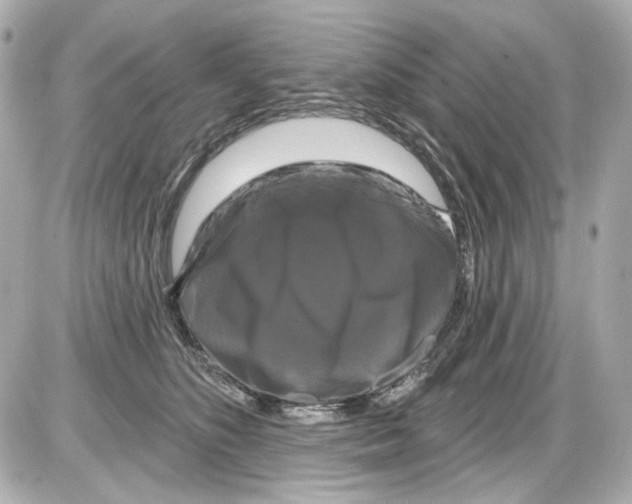 X0000085320516200704092352