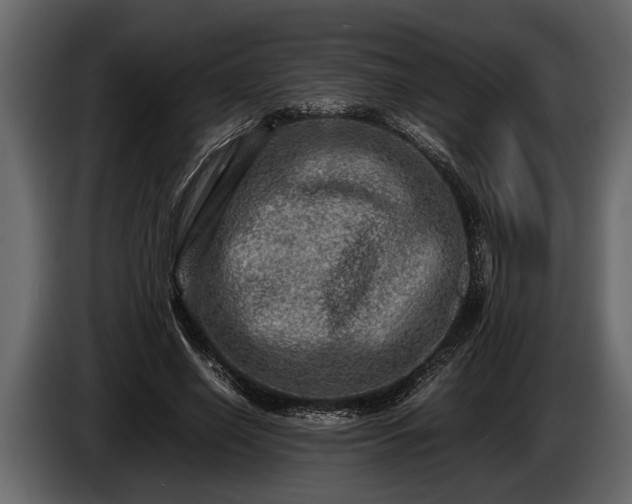 X0000085730638200703231049