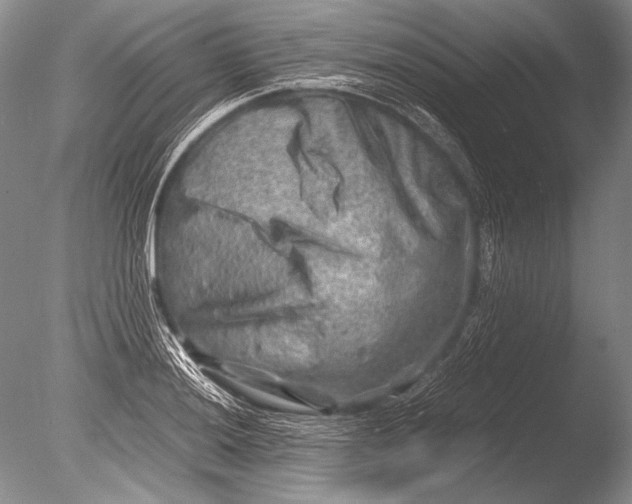 X0000085731036200703301356