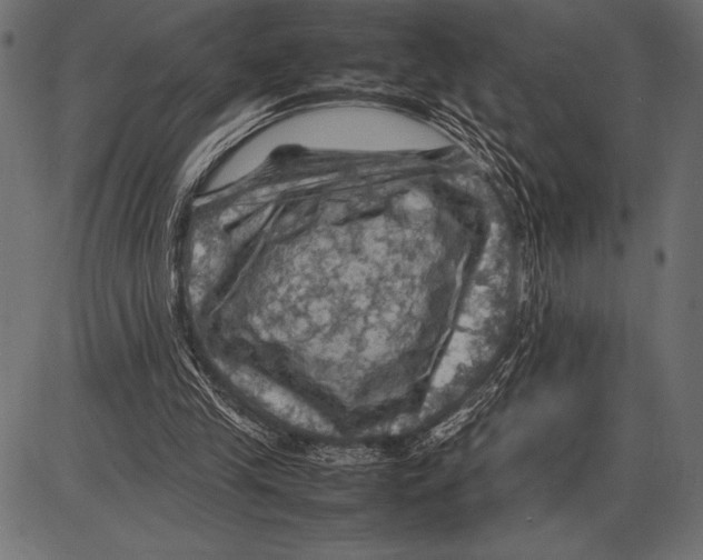 X0000085730245200704091451