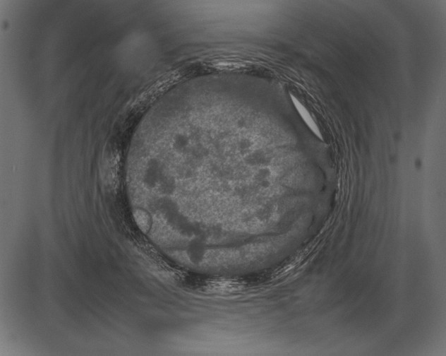 X0000085730319200704091451