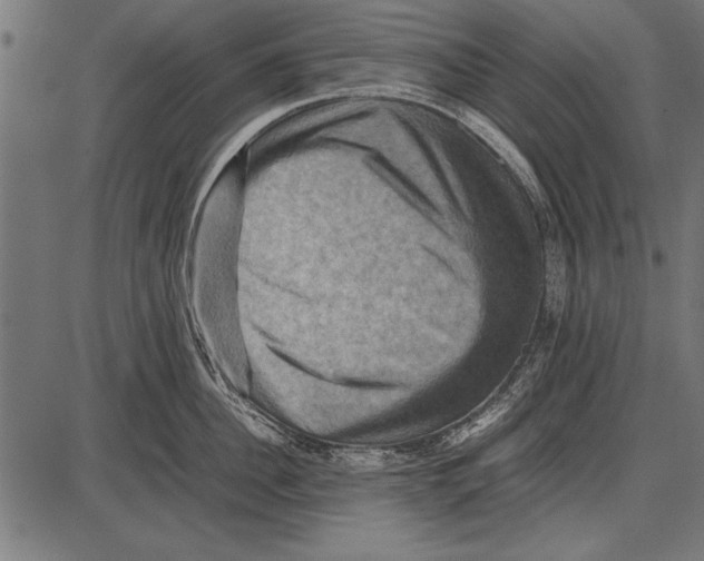 X0000085730956200704091441