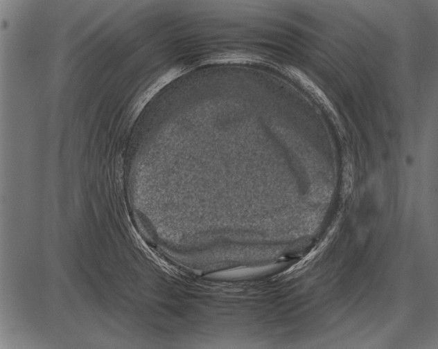 X0000085731329200704091434