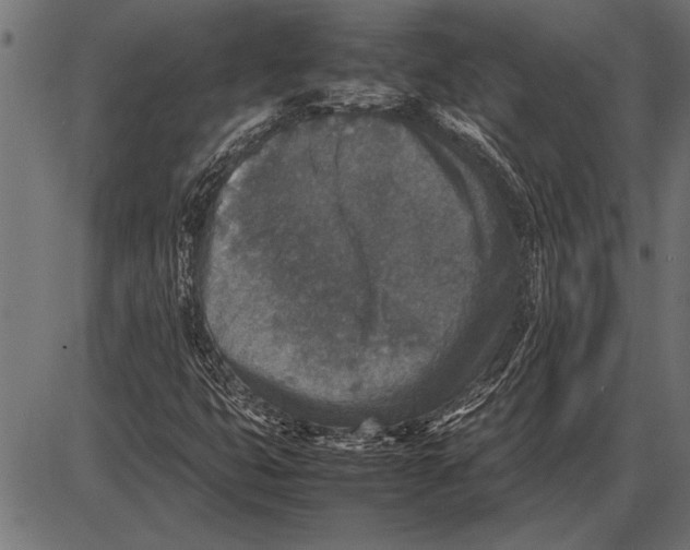 X0000085731399200704091432