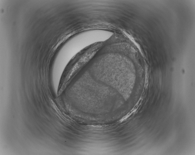 X0000085730154200704131628