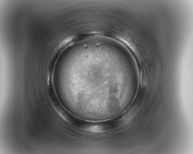 X0000085740157200703161036