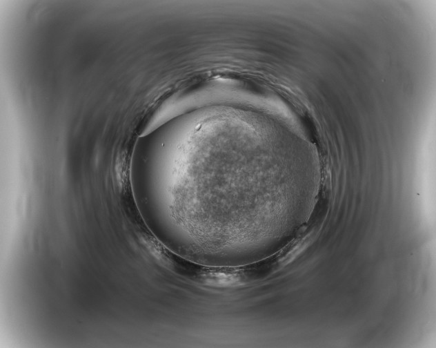 X0000085740285200703161035