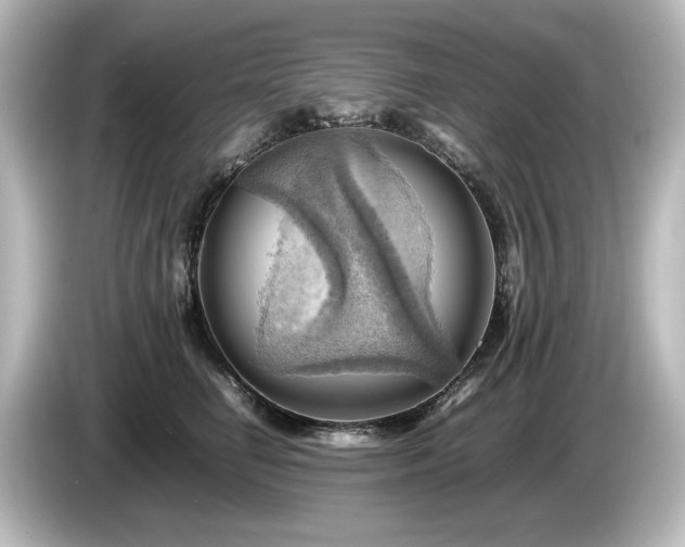 X0000085740662200703161029