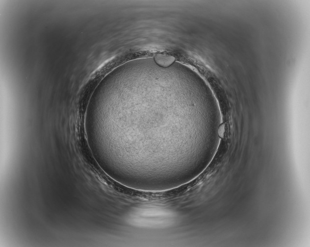 X0000085741158200703161021