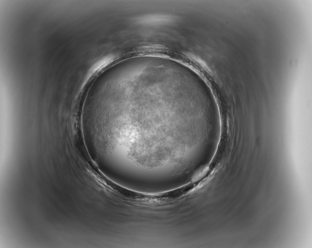 X0000085741405200703161017