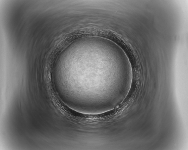 X0000085741489200703161016