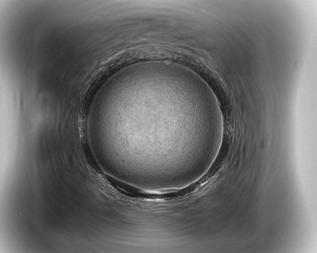 X0000085741490200703161016